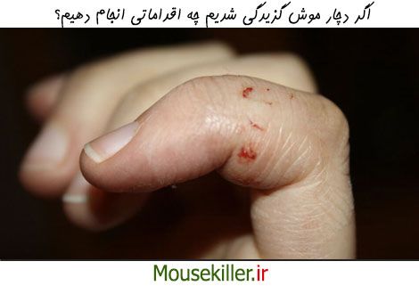 اگر موش ما را گاز گرفت چه کارهایی باید انجام دهیم؟